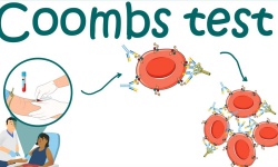 Coombs Test